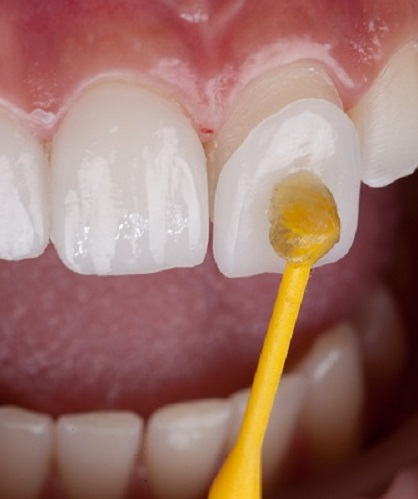 Cosmetic Dentist in Harare